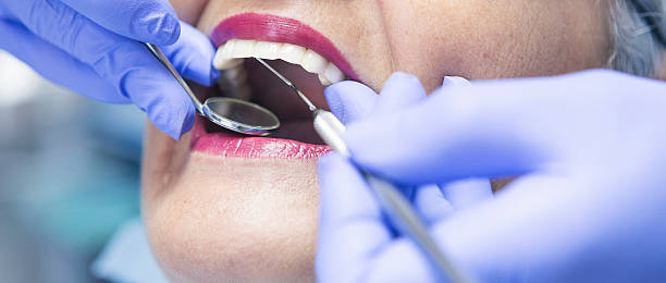 Best Emergency Dental Care for Broken or Chipped Teeth in Gunter, TX
